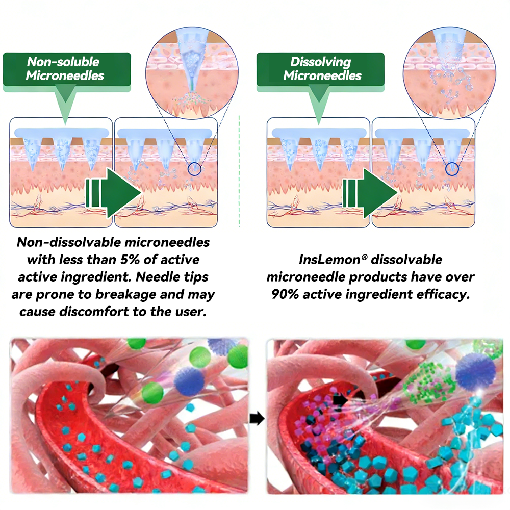 𝐅𝐃𝐀 𝐑𝐞𝐠𝐢𝐬𝐭𝐞𝐫𝐞𝐝 & 𝐆𝐌𝐏 𝐂𝐞𝐫𝐭𝐢𝐟𝐢𝐞𝐝 🧪| 𝐈𝐧𝐬𝐋𝐞𝐦𝐨𝐧® 𝑴𝒐𝒓𝒊𝒏𝒈𝒂 & 𝑩𝒆𝒓𝒃𝒆𝒓𝒊𝒏𝒆 𝟏𝟎-𝐈𝐍-𝟏 𝐀𝐝𝐯𝐚𝐧𝐜𝐞𝐝 𝐍𝐚𝐧𝐨 𝐌𝐢𝐜𝐫𝐨𝐧𝐞𝐞𝐝𝐥𝐞 𝐏𝐚𝐭𝐜𝐡 | ✅ 𝐁𝐚𝐜𝐤𝐞𝐝 𝐛𝐲 𝐒𝐜𝐢𝐞𝐧𝐭𝐢𝐟𝐢𝐜 𝐄𝐯𝐢𝐝𝐞𝐧𝐜𝐞 | 𝟏𝟎-𝐢𝐧-𝟏 𝐅𝐨𝐫𝐦𝐮𝐥𝐚 | 𝐑𝐞𝐬𝐮𝐥𝐭𝐬 𝐢𝐧 𝟓 𝐃𝐚𝐲𝐬