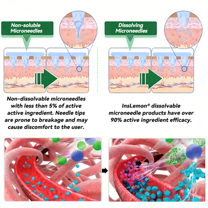 𝐅𝐃𝐀 𝐑𝐞𝐠𝐢𝐬𝐭𝐞𝐫𝐞𝐝 & 𝐆𝐌𝐏 𝐂𝐞𝐫𝐭𝐢𝐟𝐢𝐞𝐝 🧪| 𝐈𝐧𝐬𝐋𝐞𝐦𝐨𝐧® 𝑴𝒐𝒓𝒊𝒏𝒈𝒂 & 𝑩𝒆𝒓𝒃𝒆𝒓𝒊𝒏𝒆 𝟏𝟎-𝐈𝐍-𝟏 𝐀𝐝𝐯𝐚𝐧𝐜𝐞𝐝 𝐍𝐚𝐧𝐨 𝐌𝐢𝐜𝐫𝐨𝐧𝐞𝐞𝐝𝐥𝐞 𝐏𝐚𝐭𝐜𝐡 | ✅ 𝐁𝐚𝐜𝐤𝐞𝐝 𝐛𝐲 𝐒𝐜𝐢𝐞𝐧𝐭𝐢𝐟𝐢𝐜 𝐄𝐯𝐢𝐝𝐞𝐧𝐜𝐞 | 𝟏𝟎-𝐢𝐧-𝟏 𝐅𝐨𝐫𝐦𝐮𝐥𝐚 | 𝐑𝐞𝐬𝐮𝐥𝐭𝐬 𝐢𝐧 𝟓 𝐃𝐚𝐲𝐬