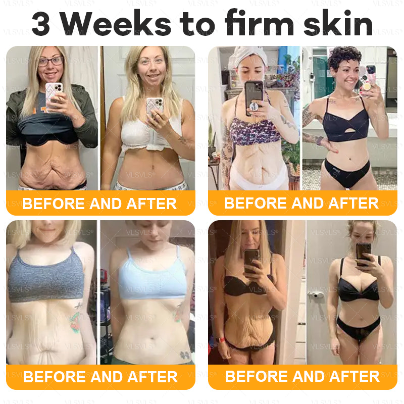 VLSVLS®--Only 10 jars! Grab an exclusive 30% discount now! Keep your skin youthful and glowing in just 1 to 3 weeks. Don’t miss your chance—this offer won’t come around again until next year. Act fast! 180-day money back guarantee!