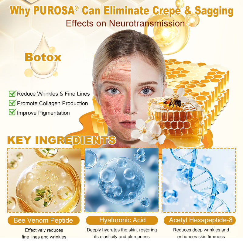 𝑷𝑼𝑹𝑶𝑺𝑨® 𝘽𝙀𝙀 𝙑𝙀𝙉𝙊𝙈 𝙎𝙠𝙞𝙣 𝙍𝙚𝙨𝙩𝙤𝙧𝙖𝙩𝙞𝙤𝙣 𝘾𝙧𝙚𝙖𝙢 – 🌸Targets Sagging Skin, Fine Lines, and Loss of Firmness on Chest, Neck & Body | Lifts & Firms Naturally 🔥 LAST DAY: 80% OFF!