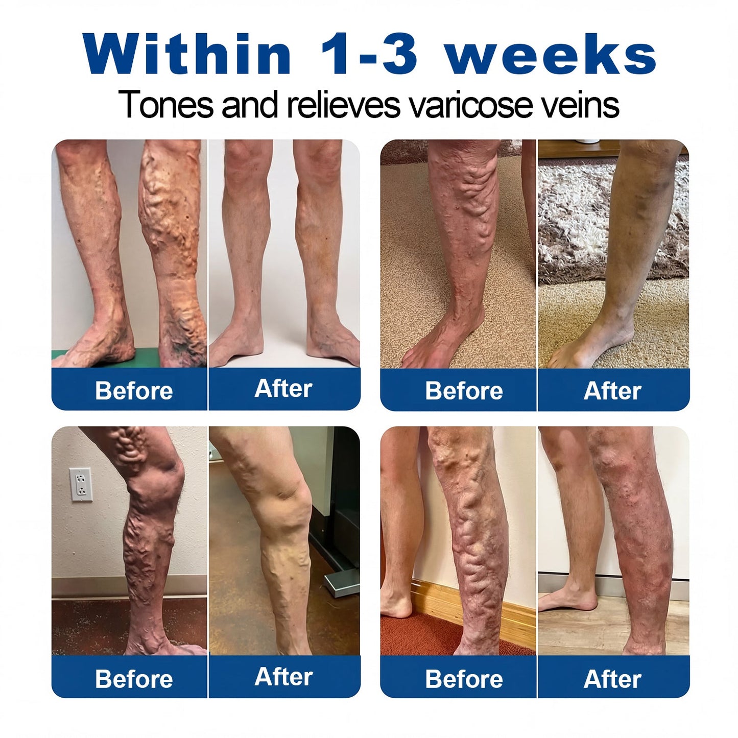 🇺🇸👨‍⚕️✅✅Lexasky® VEIN EASE MICRONEEDLE CARE PATCH⚡Instant Relief, Long-Term Results