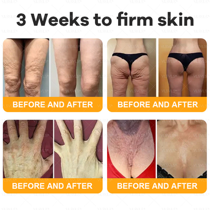VLSVLS®--Only 10 jars! Grab an exclusive 30% discount now! Keep your skin youthful and glowing in just 1 to 3 weeks. Don’t miss your chance—this offer won’t come around again until next year. Act fast! 180-day money back guarantee!
