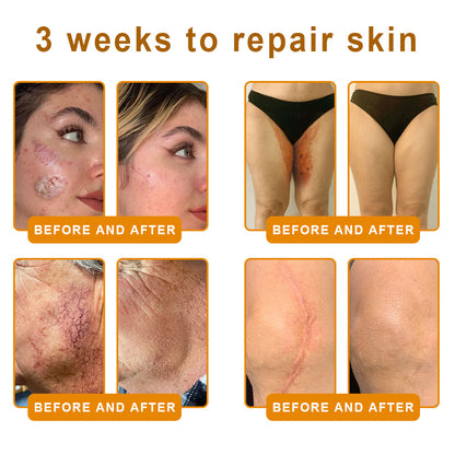 𝑷𝑼𝑹𝑶𝑺𝑨® 𝘽𝙀𝙀 𝙑𝙀𝙉𝙊𝙈 𝙎𝙠𝙞𝙣 𝙍𝙚𝙨𝙩𝙤𝙧𝙖𝙩𝙞𝙤𝙣 𝘾𝙧𝙚𝙖𝙢 – 🌸Targets Sagging Skin, Fine Lines, and Loss of Firmness on Chest, Neck & Body | Lifts & Firms Naturally 🔥 LAST DAY: 80% OFF!