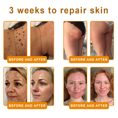 𝑷𝑼𝑹𝑶𝑺𝑨® 𝘽𝙀𝙀 𝙑𝙀𝙉𝙊𝙈 𝙎𝙠𝙞𝙣 𝙍𝙚𝙨𝙩𝙤𝙧𝙖𝙩𝙞𝙤𝙣 𝘾𝙧𝙚𝙖𝙢 – 🌸Targets Sagging Skin, Fine Lines, and Loss of Firmness on Chest, Neck & Body | Lifts & Firms Naturally 🔥 LAST DAY: 80% OFF!