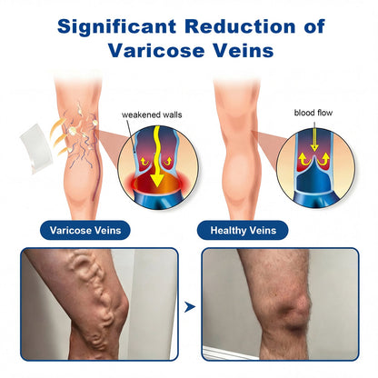 🇺🇸👨‍⚕️✅✅Lexasky® VEIN EASE MICRONEEDLE CARE PATCH⚡Instant Relief, Long-Term Results