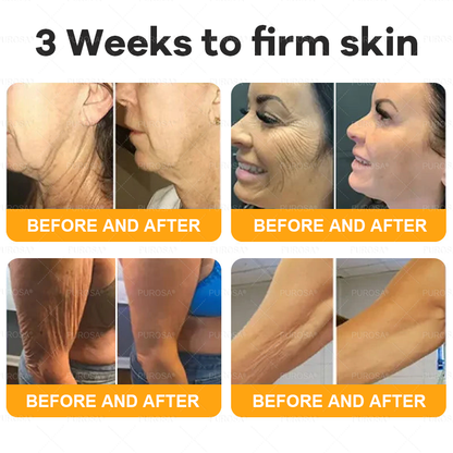 𝑷𝑼𝑹𝑶𝑺𝑨® 𝘽𝙀𝙀 𝙑𝙀𝙉𝙊𝙈 𝙎𝙠𝙞𝙣 𝙍𝙚𝙨𝙩𝙤𝙧𝙖𝙩𝙞𝙤𝙣 𝘾𝙧𝙚𝙖𝙢 – 🌸Targets Sagging Skin, Fine Lines, and Loss of Firmness on Chest, Neck & Body | Lifts & Firms Naturally 🔥 LAST DAY: 80% OFF!