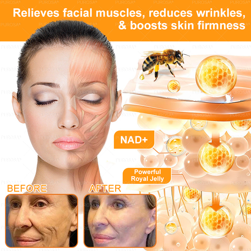 𝑷𝑼𝑹𝑶𝑺𝑨® 𝘽𝙀𝙀 𝙑𝙀𝙉𝙊𝙈 𝙎𝙠𝙞𝙣 𝙍𝙚𝙨𝙩𝙤𝙧𝙖𝙩𝙞𝙤𝙣 𝘾𝙧𝙚𝙖𝙢 – 🌸Targets Sagging Skin, Fine Lines, and Loss of Firmness on Chest, Neck & Body | Lifts & Firms Naturally 🔥 LAST DAY: 80% OFF!