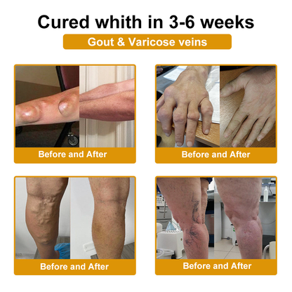 DR.HONOR® — 🚨 Only 10 jars left! Grab an exclusive 30% OFF today!Support flexibility and mobility in just 1–3 weeks.Don’t miss your chance—this offer won’t come around again until next year. Act fast! 180-day money back guarantee!🔥